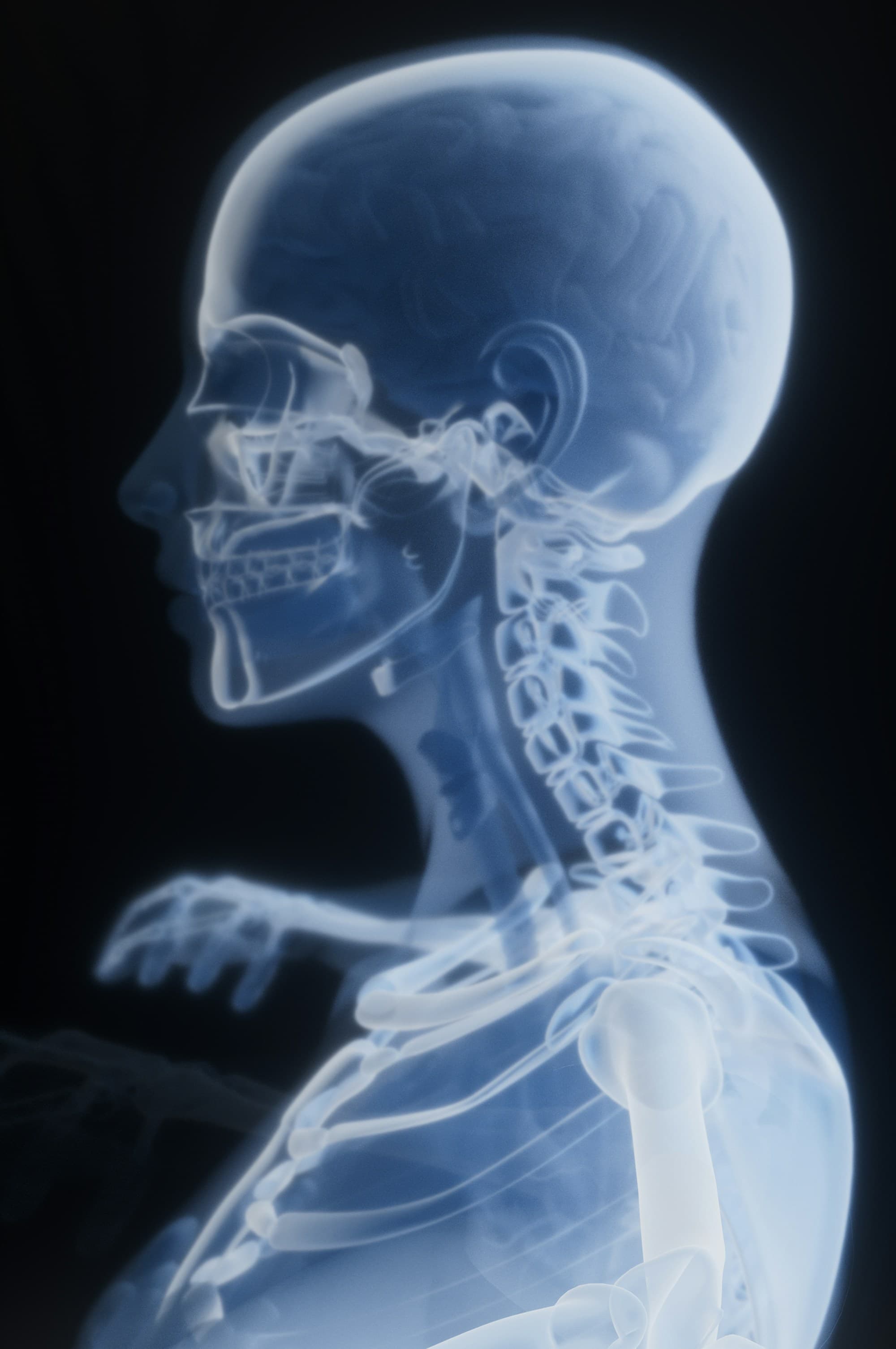 Lateral X-ray view of the head, neck and cervical column showing the upper airway