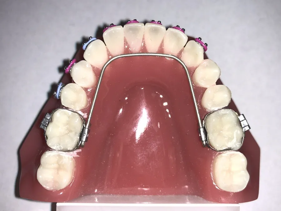Size 0 FRLA (5-Pack)