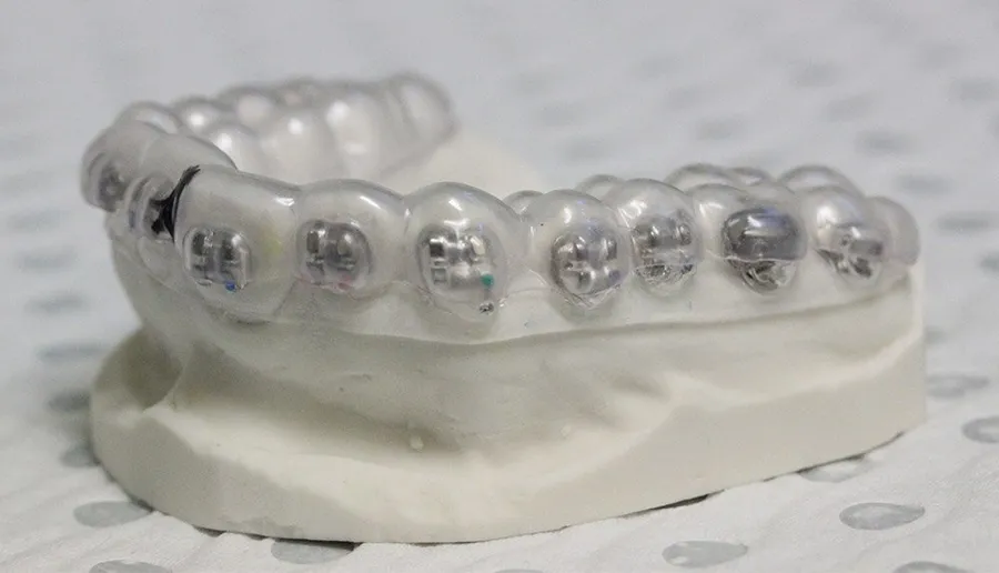 Indirect Bonding Tray  25/pkg