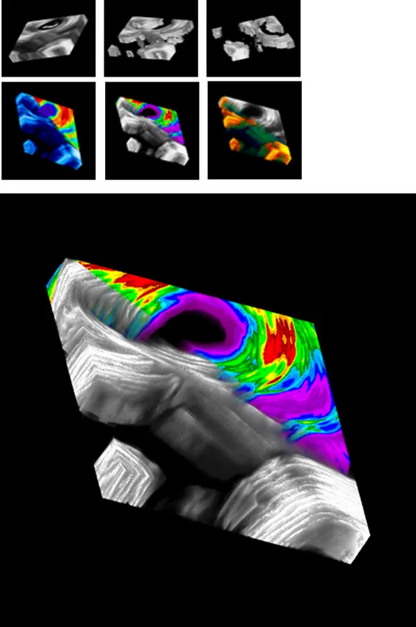 3D Bone Structure