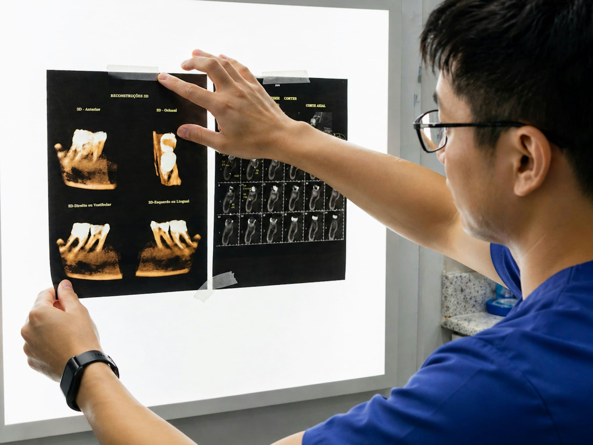 Clinician reviewing CBCT reconstructions on a light board